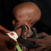 Mortalité infantile « alarmante » dans le monde, selon l’ONU