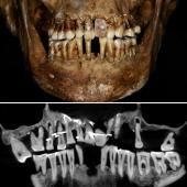 Une aristocrate du 17e siècle racontée par sa dentition