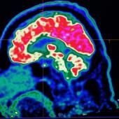 Un « décodeur » de pensées grâce à l’imagerie cérébrale et l’intelligence artificielle