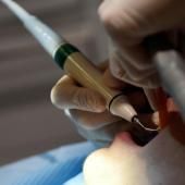 Cherbourg : les patients d&#039;un dentiste appelés à se faire dépister