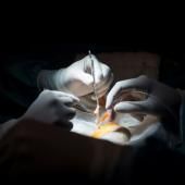 Les greffes d'organe remontent mais sans rattraper le niveau d'avant-Covid
