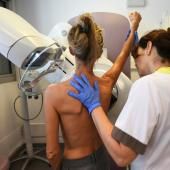 Nouvel espoir pour le traitement de certains cancers du sein agressifs 