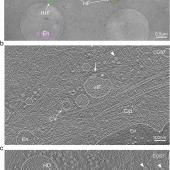 Des scientifiques découvrent un organite inconnu à l&#039;intérieur de nos cellules