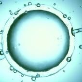 Voir la vidéo de Des ovocytes humains créés à partir de cellules de peau