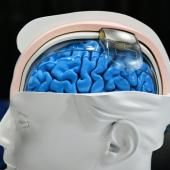 &quot;On est déjà dans la science-fiction&quot;: la discrète révolution des neurotechnologies 