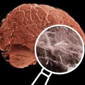 Voir la vidéo de Ils cartographient le corps humain avec une définition folle !