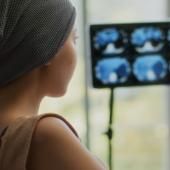 Voir la vidéo de Pourquoi les cancers explosent-ils chez les moins de 50 ans ? 