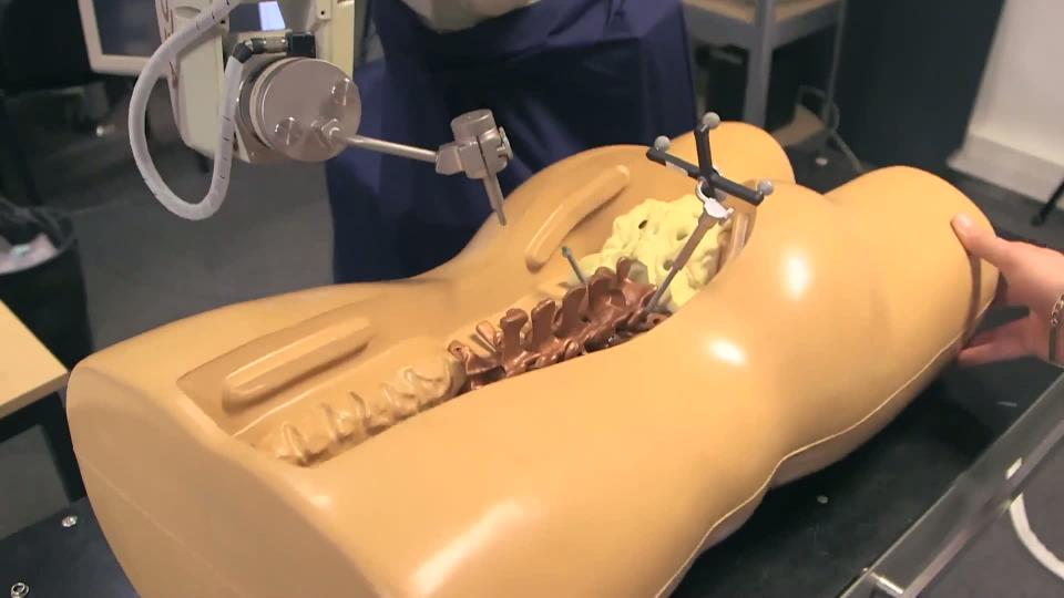 Les robots chirurgiens