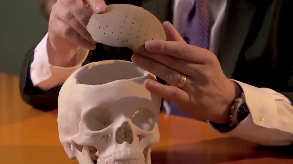 Des greffes osseuses innovantes